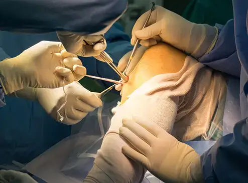 CHIRURGIE ORTHOPÉDIQUE